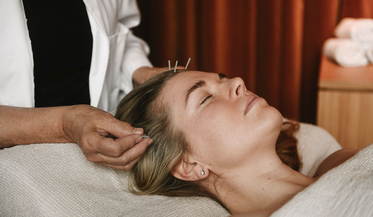 Facial acupuncture stimulates collagen and circulation — part of Niki Newd® natural rejuvenation rituals.